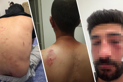 Mersin’de Irkçı Saldırı: Bebek ve Yaşlı Kadın Yaralandı